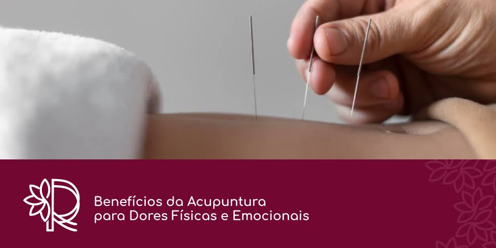 Benefícios da Acupuntura para Dores Físicas e Emocionais