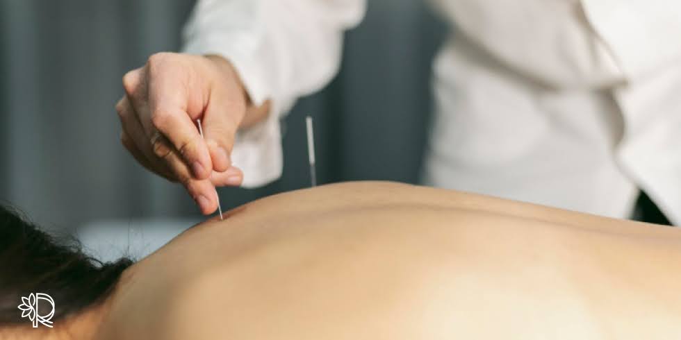 Benefícios da Acupuntura para Dores Físicas e Emocionais