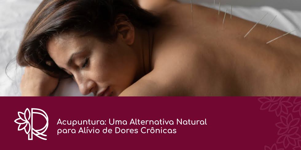 Acupuntura: Uma Alternativa Natural para Alívio de Dores Crônicas